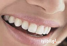 İşte dişleri beyazlatmanın 10 kuralı!